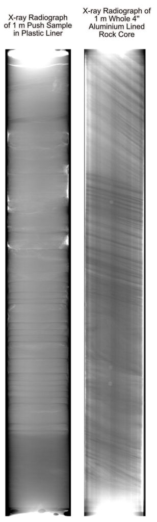 Radiograph Examples